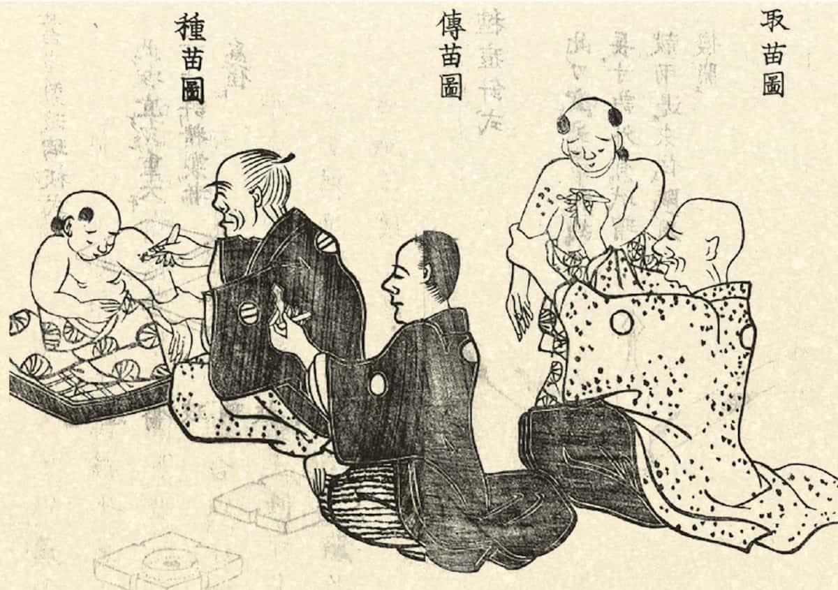 種痘の様子（『新訂牛痘奇法』京都大学附属図書館蔵）